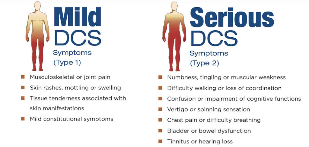 decompression sickness